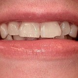 Ortho