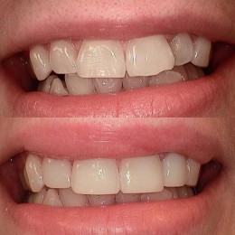 Ortho