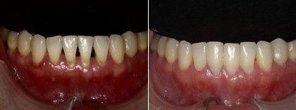 Smile 26