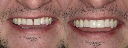 Smile 27