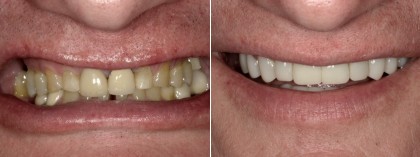 Smile 28