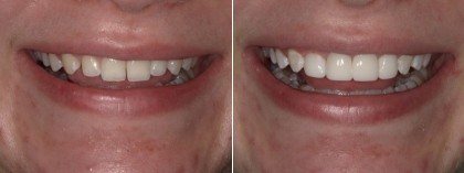Smile 31