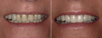 Smile 32