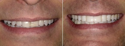 Smile 33