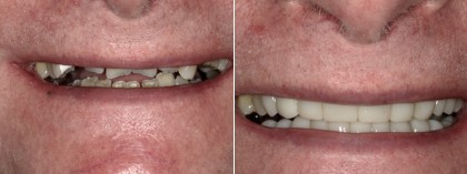 Smile 34