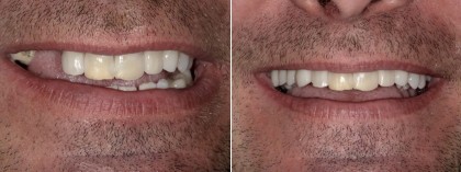 Smile 35