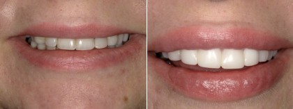 Smile 36